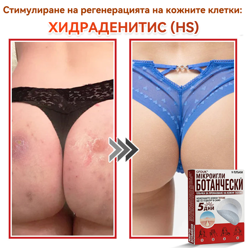 🗽✅ GFOUK® Ботаничен пластир с микроигли за премахване на кожни образувания