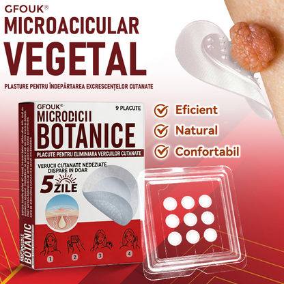 🗽✅ GFOUK® Plasture botanic cu microace pentru îndepărtarea verucilor și a negilor