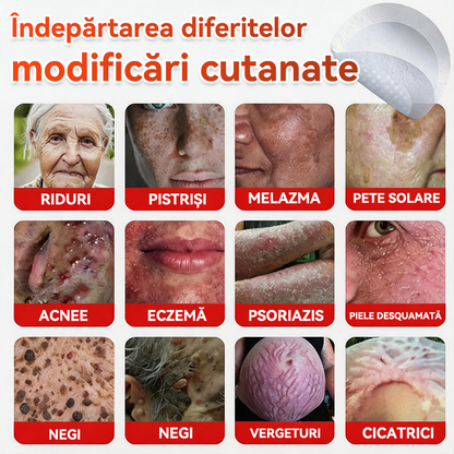 ⏰🔥✅ GFOUK® Plasture botanic cu microace pentru îndepărtarea verucilor și a negilor